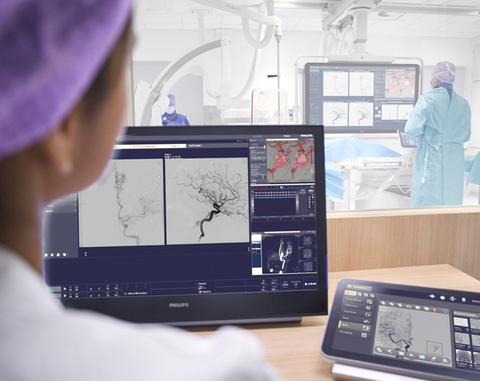 Philips Azurion