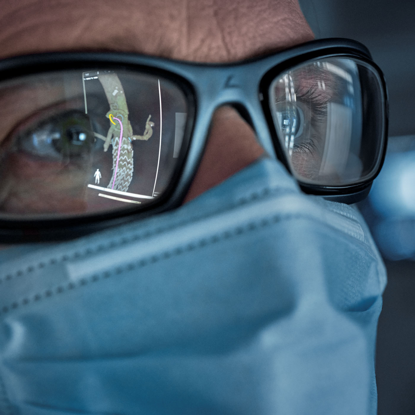 Close-up of a person's face wearing glasses in an image-guided therapy scenario