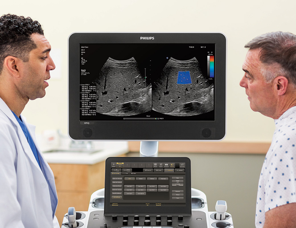 Ultrasound examination using Philips EPIQ ElastQ