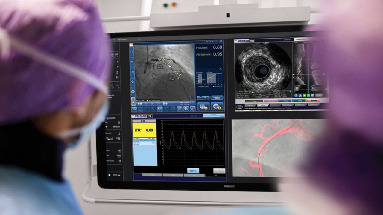 Peripheral intravascular ultrasound (IVUS)